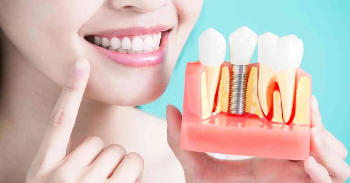 Experience World-Class Dental Implant Services in Istanbul, Turkey
