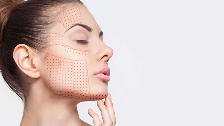Attain Flawless Youthful Beauty with Non-Surgical Thread Lifting and HIFU Therapy